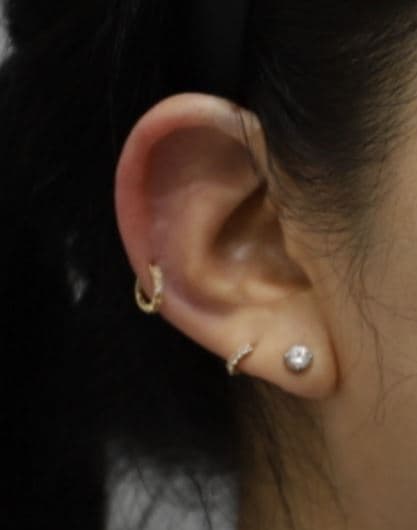 Ear Filler — after