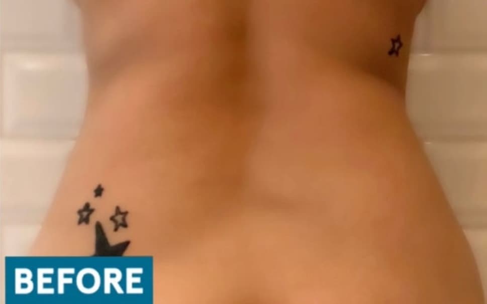 Sok-Sok Body Injection — Before