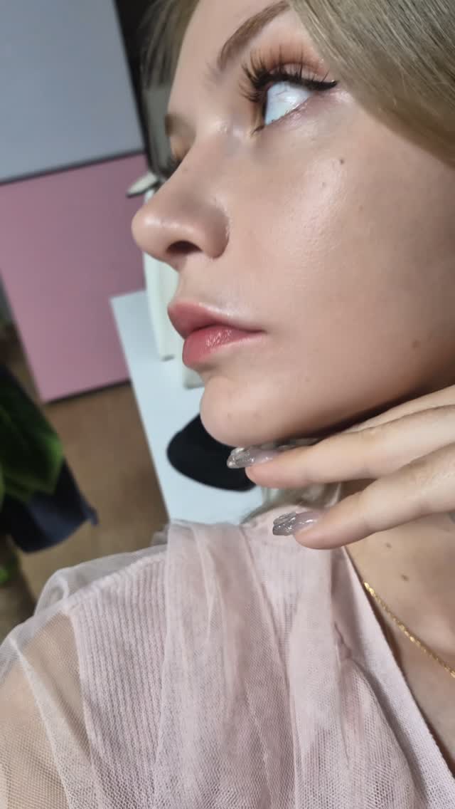 Lip Filler Dissolve & Refill — A Real Patient Review