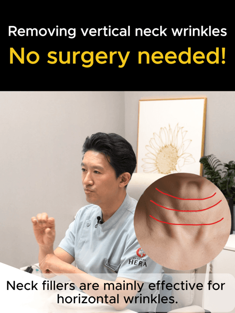 Say goodbye to vertical neck wrinklesβWITHOUT surgery! π
ββοΈβ¨ Vertical neck lines used to be the hardest to treat, often needing a surgical neck lift. But the trend has changed NOW Introducing the CaHA Skin Booster treatment! π By spreading diluted calcium filler evenly under the vertical folds, we stimulate your skin to regain its firmness and bounce naturally. Perfect for β
Loss of skin elasticity β
Deep vertical neck bands β
Those wanting surgical results without the downtime The future of neck rejuvenation is here at Gangnam Hera. π€